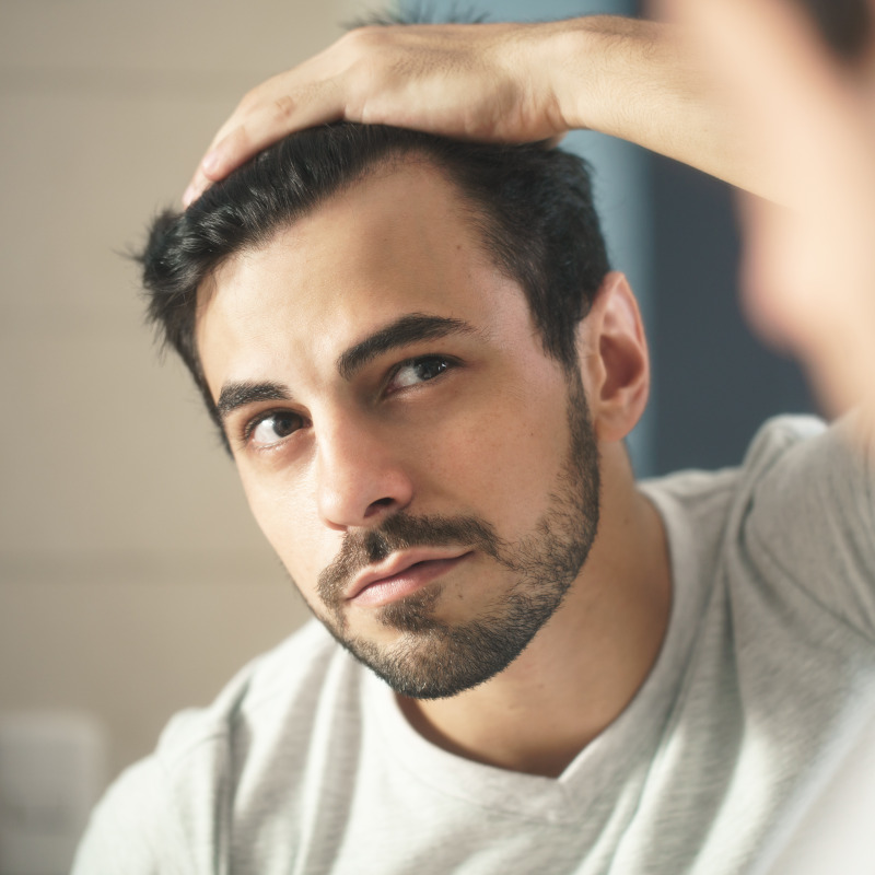 About Hair Loss
